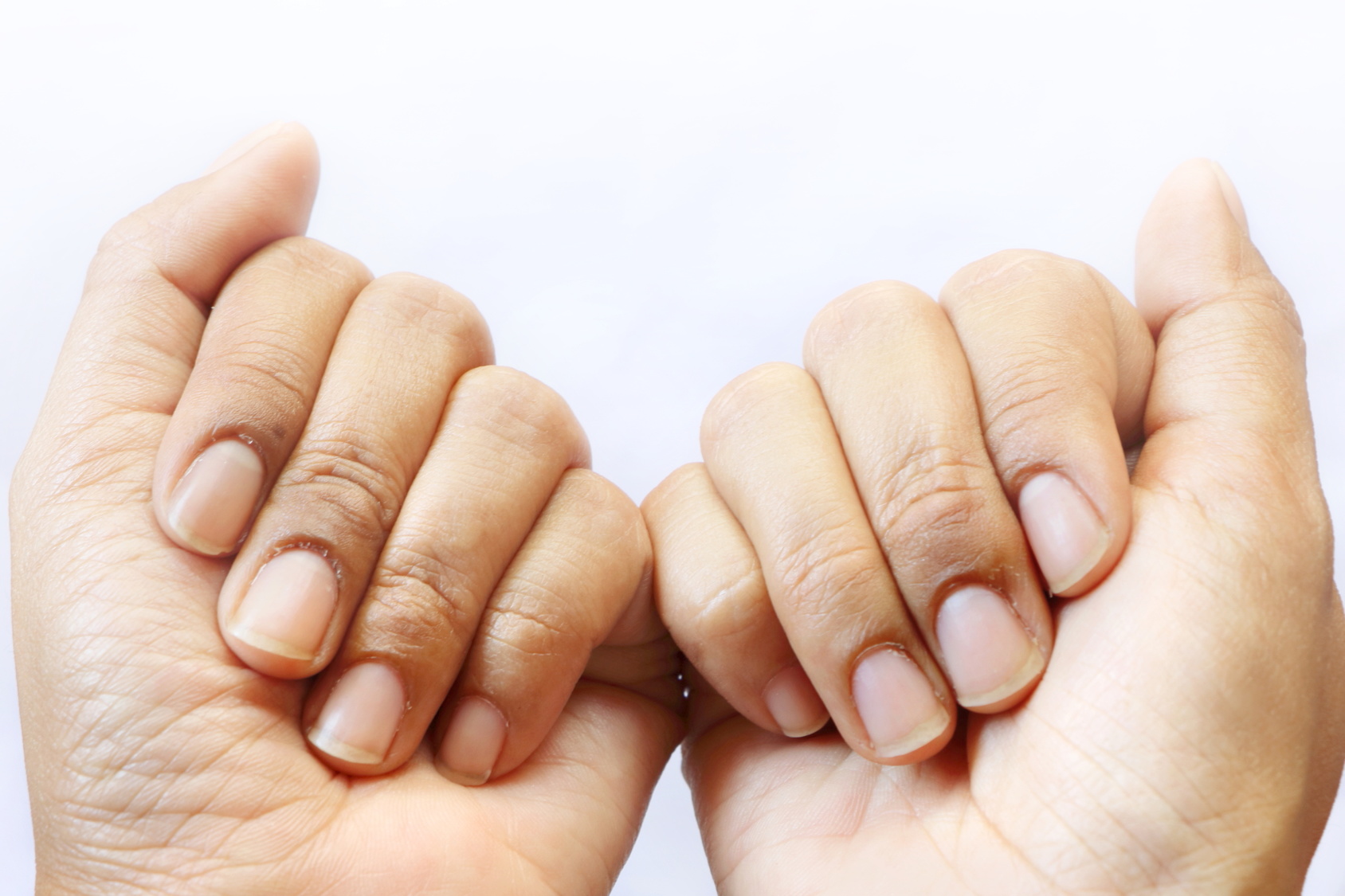 Желтые ногти после маникюра: причины и методы борьбы с желтизной