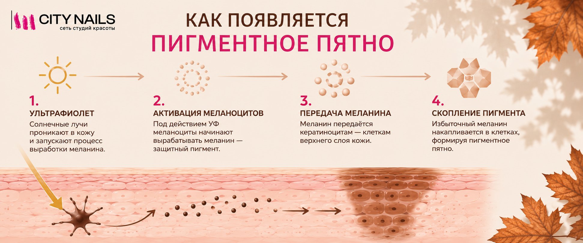 Как появляется пигментное пятно