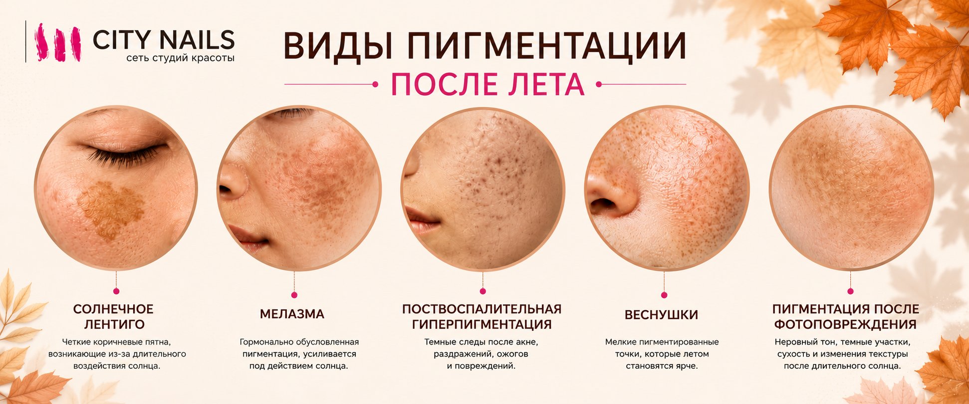 Виды пигментации после лета