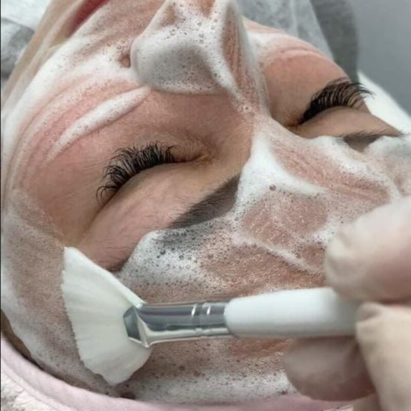 photo-5217665896732626734-x