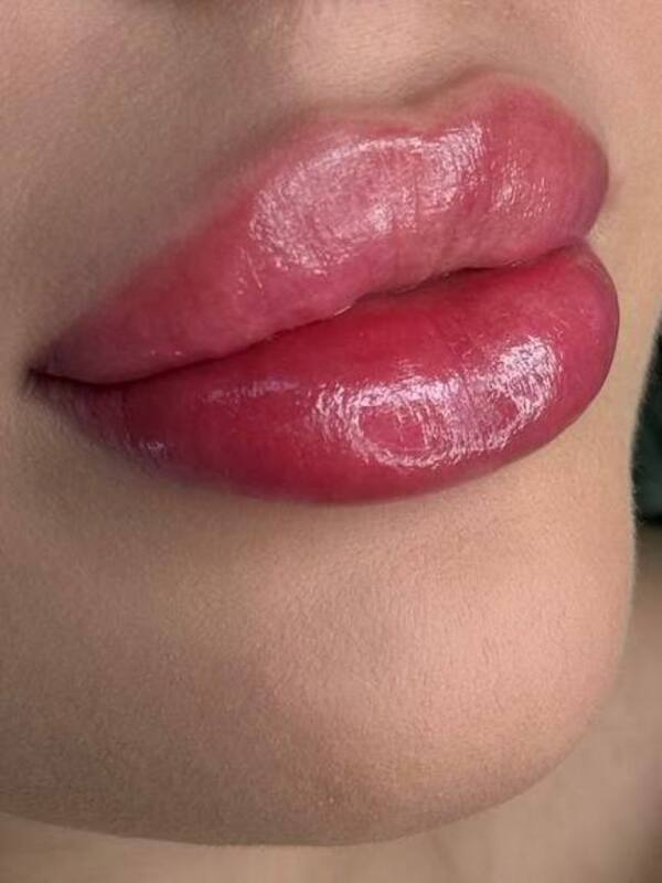 photo-5474297794756998203-x