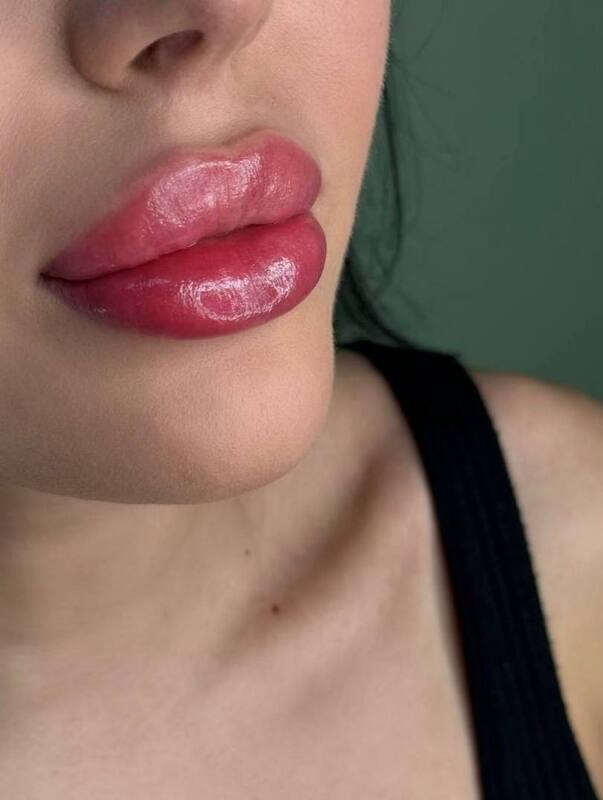 photo-5474297794756998228-y